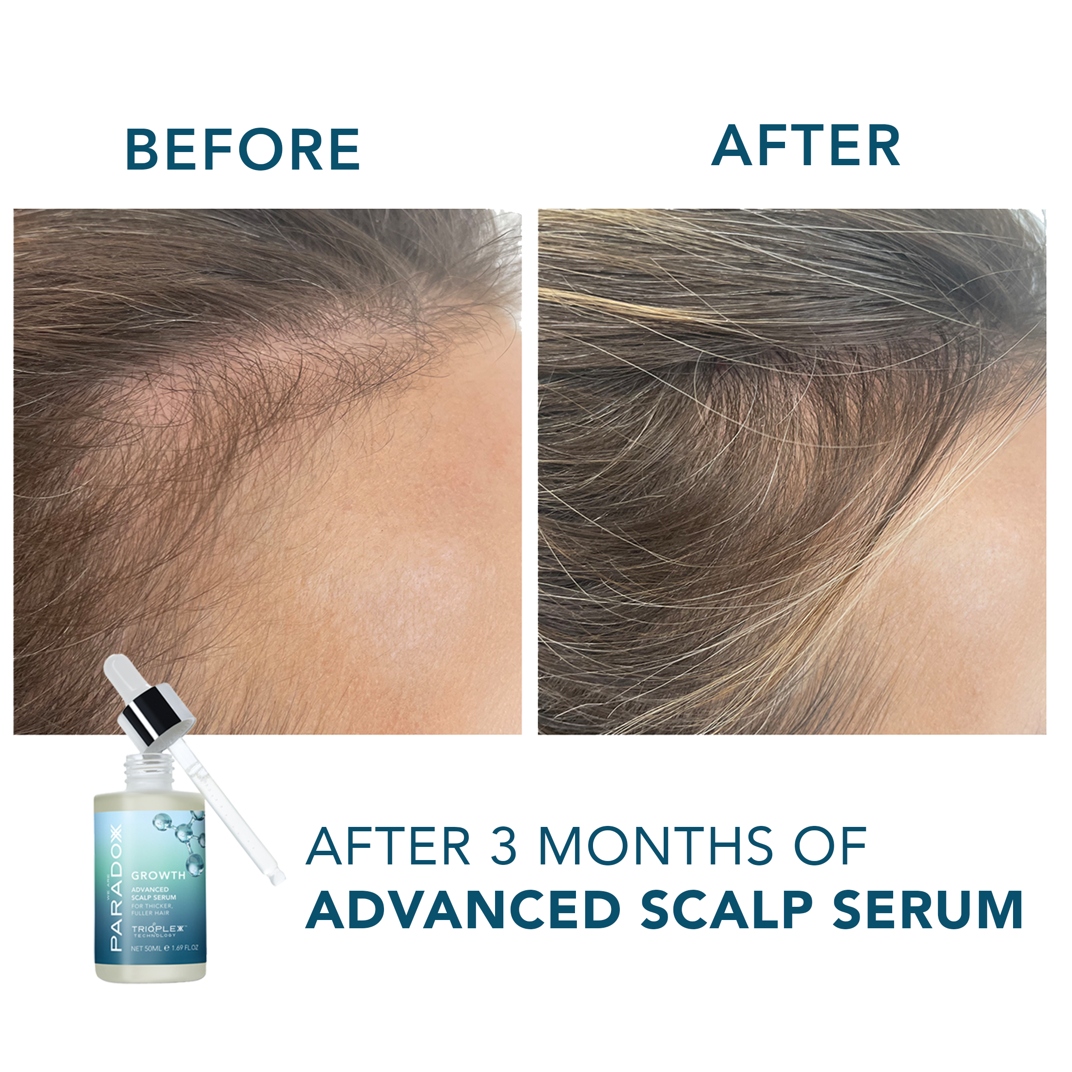 Growth Advanced Scalp Serum